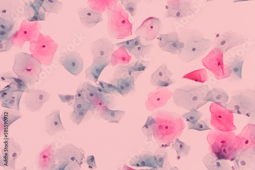 View in microscopic of normal human cervix cells.Squamous epithelial cells.Photo of Human skin cells.Superficial and intermediate epithelial cells.Cytology and pathology laboratory department.