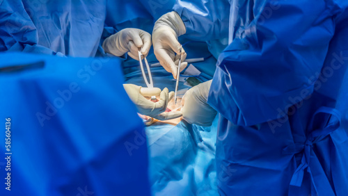 Doctor or surgeon did surgery of hernia mesh repair operation inside operating room in hospital. Open repair of inguinal hernia in groin mass patient.Medical mesh device was use with blur background. photo
