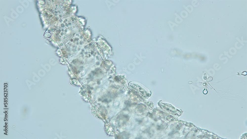 Infusoria Ciliophora Trichodina sp. under microscope, family Trichodinidae. They move around the body of Hydra and are commensal