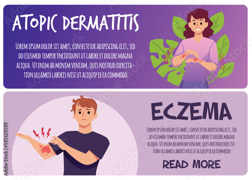 Atopic dermatitis and eczema web banners set, flat vector illustration. People suffering from skin inflammation.