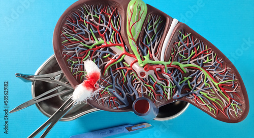 Tableau sur toile Scalpel and anatomical figure of human liver