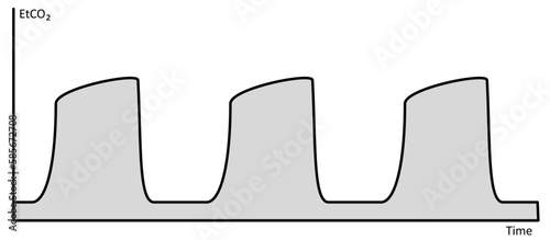 End-Tidal Capnography Waveform
