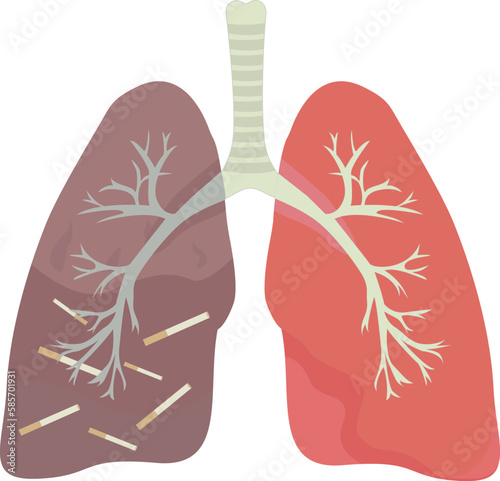 Healthy and sick human lungs with trachea vector illustration