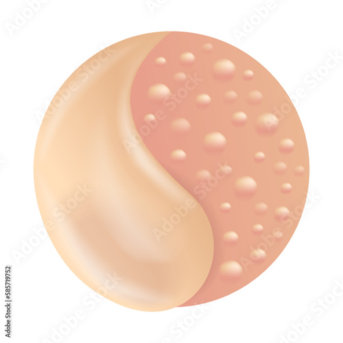 Skin Fungus treatment 3D icon photo