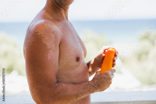 Billede på lærred Close-up Of A Red Shoulder And Back Of A Man With A Sunburned Skin