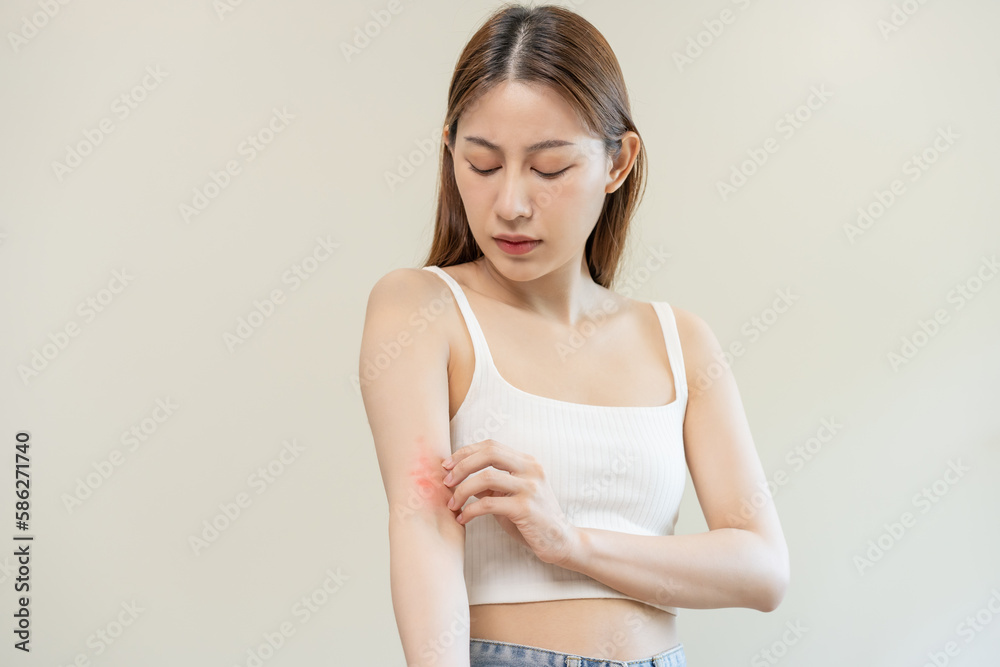 Dermatology asian young woman, girl allergy, allergic reaction from atopic, insect bites on her arm, hand in scratching itchy, itch red spot or rash of skin. Healthcare, treatment of beauty. Dermatology asian young woman, girl allergy, allergic reaction from atopic, insect bites on her arm, hand in scratching itchy, itch red spot or rash of skin. Healthcare, treatment of beauty.