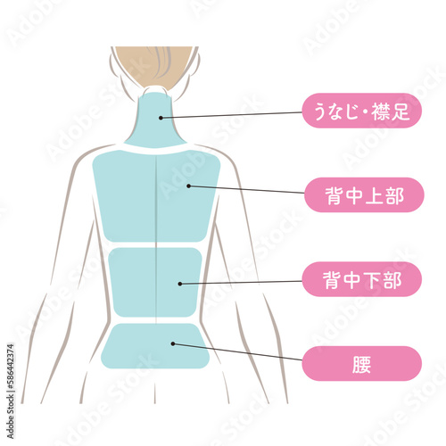 背中の脱毛の範囲