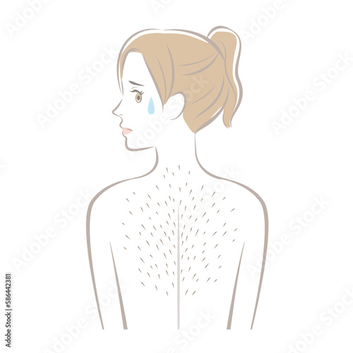背中のムダ毛に悩む女性