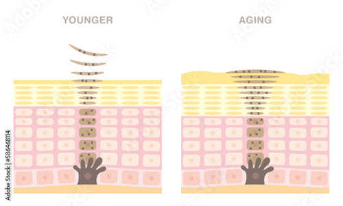 Cross section of skin cell turnover. Skin regeneration of younger and older. Older skin has spots.  Pale colored illustration in flat cartoon style.