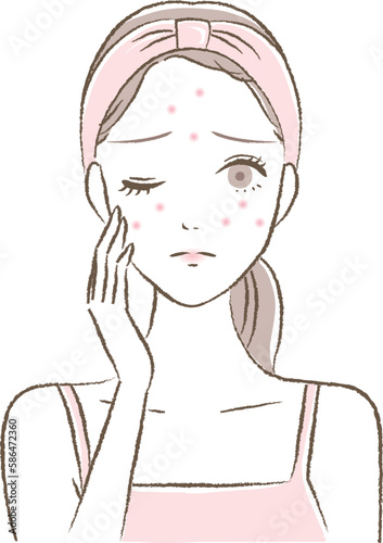 ニキビ・吹き出物などの肌トラブルに悩む女性の顔のイラスト