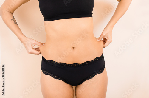 Woman with Localized Fat on Flanks photo