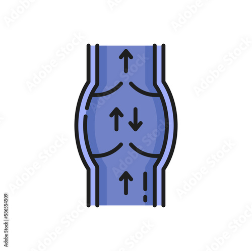 Abnormal blood flow, weak varicose vein not closed valve, isolated outline icon. Vector valve not closed or damaged, blood flowing in both directions