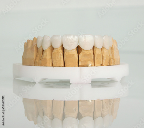 Dental lower jaw ceramic zircon veneers on white background on model.