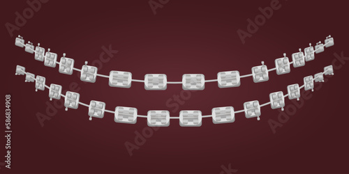 The concept of teeth alignment with braces. Orthodontic dentistry. The alignment of the teeth. Beautiful white teeth. Isolated flat vector illustration. Simple teeth in a row. Orthodontic treatment.