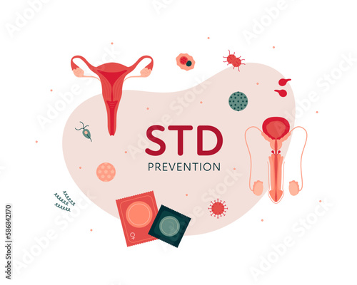 Sexual transmitted disease banner template concept. Vector flat healthcare illustration. STD prevention with various icon symbol. Penis and vagina reproduction organ. Design for awareness month