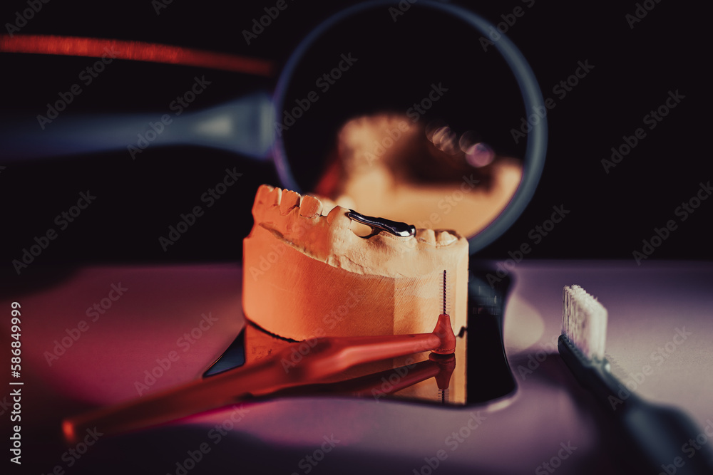 Keep your smile healthy and beautiful with dental spacers. Prevent overcrowding and other dental