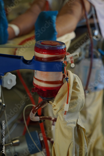 Training of medical interns in the ECMO technique Extracorporeal Membrane Oxygenation. photo