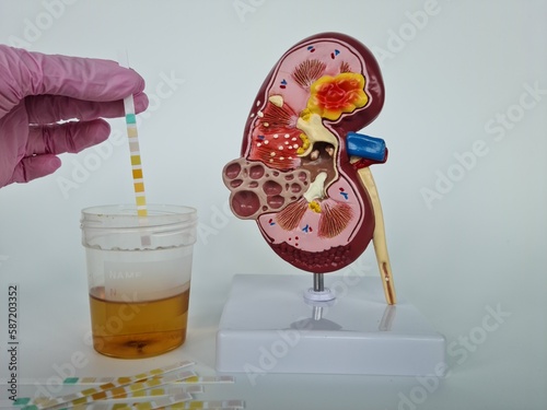 Urologist doctor makes express analysis of urine using indicator paper closeup photo