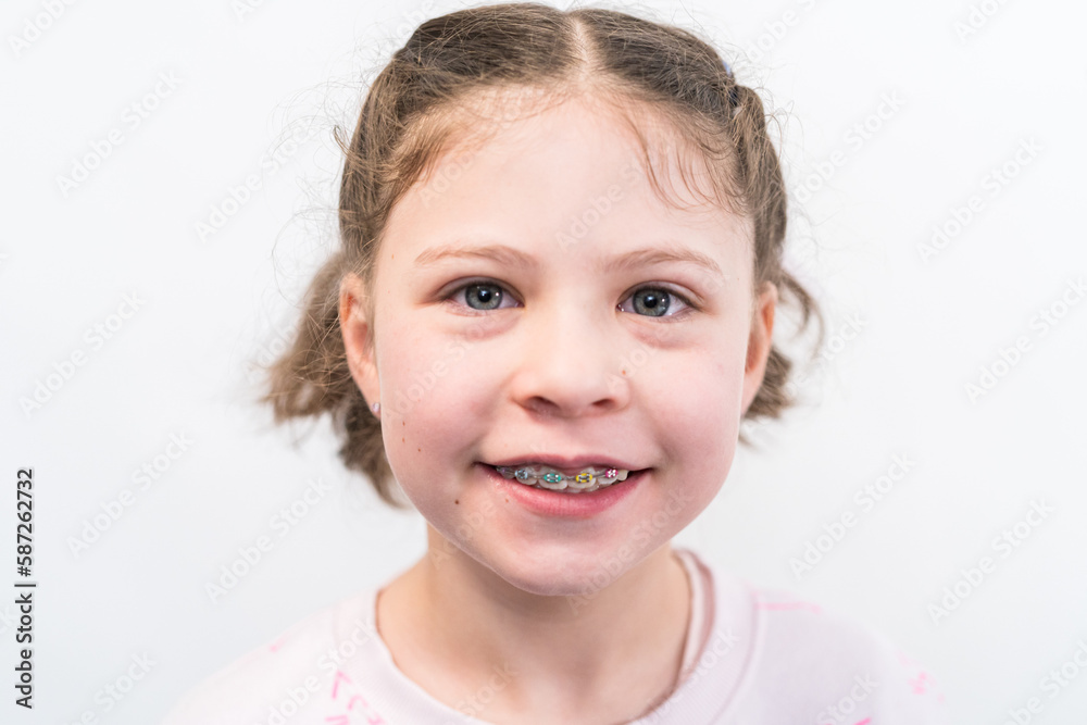 Little girl with rainbow braces