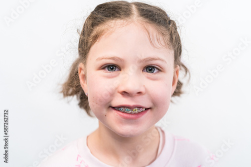 Little girl with rainbow braces