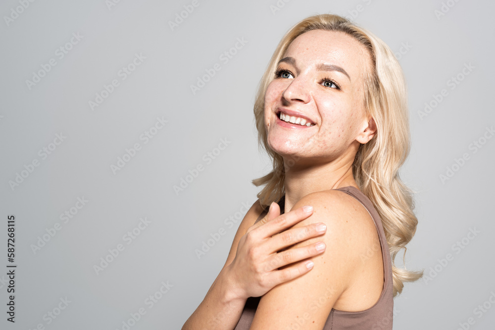 Positive blonde woman with acne touching shoulder isolated on grey. Positive blonde woman with acne touching shoulder isolated on grey.