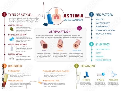 Everything you need to know about asthma: types, diagnosis, risk factors, symptoms, treatment and how to manage an asthma attack. photo