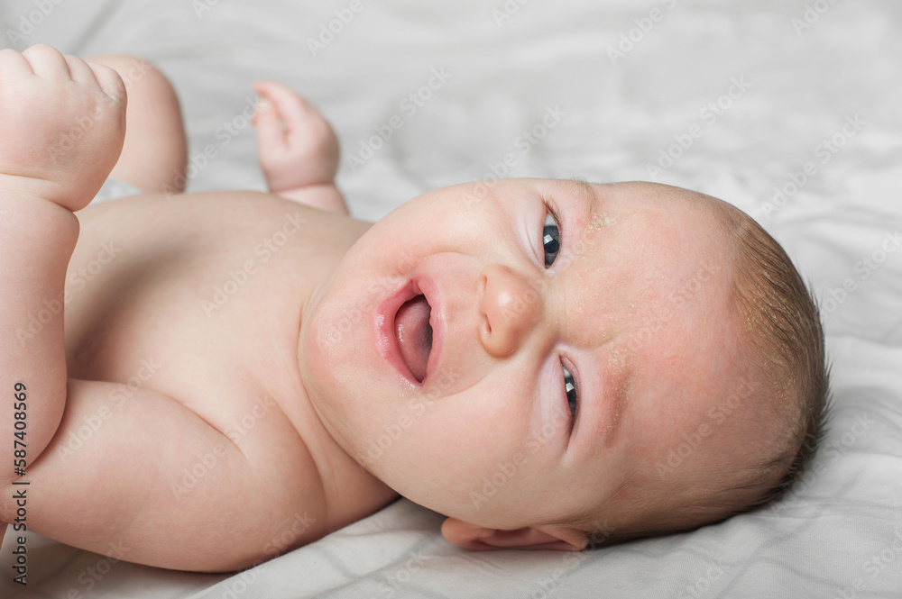 Newborn baby 2 months old with atopic dermatitis close up portrait. Baby care, colic, teething, crying. Newborn baby 2 months old with atopic dermatitis close up portrait. Baby care, colic, teething, crying.