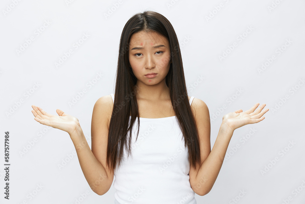 Asian woman facial skin problems, acne and inflammation, red rashes and allergies, chicken pox, sadness from rashes. Facial skin care concept for diseases and nerves Asian woman facial skin problems, acne and inflammation, red rashes and allergies, chicken pox, sadness from rashes. Facial skin care concept for diseases and nerves