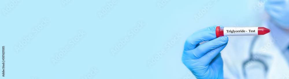 Triglyceride test result with blood sample in test tube on doctor hand in medical lab.Banner.Copy space for text Triglyceride test result with blood sample in test tube on doctor hand in medical lab.Banner.Copy space for text