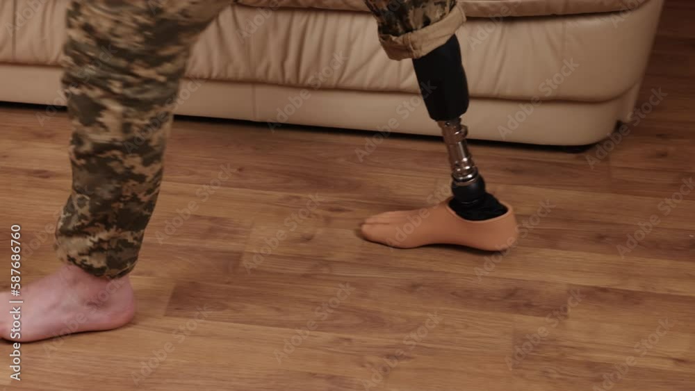 Disabled soldier, Injury compensation, Military prosthetics. Man with ...