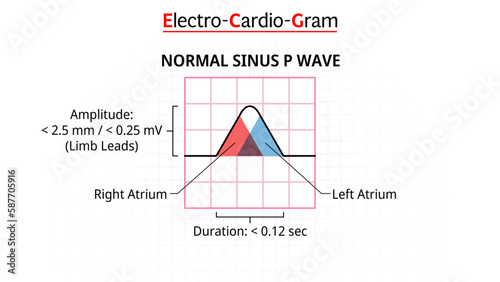 P Wave - ECG Sinus Normal - Electrocardiogram - Morphology P Wave - Vector Illustration