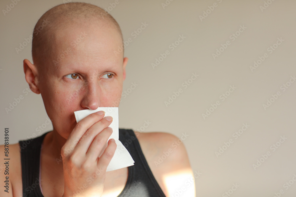 Bald cancer sick woman blowing running nose got flu cough cold, rhinitis sneezing in tissue or nosebleeds. Female is sick allergic having allergy symptoms coughing holding napkin. Misery, infelicity