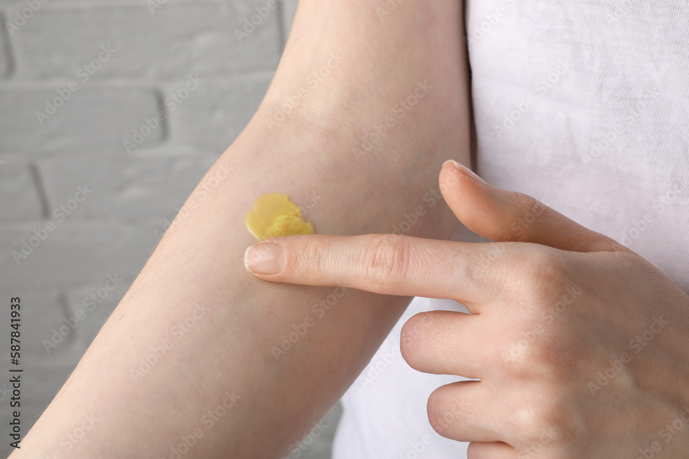 Woman applying ointment on her hand indoors, closeup Woman applying ointment on her hand indoors, closeup