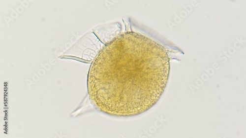 Dinophysis, a genus of dinoflagellates common in oceanic waters. Lugol-fixed sample. 400x magnification photo