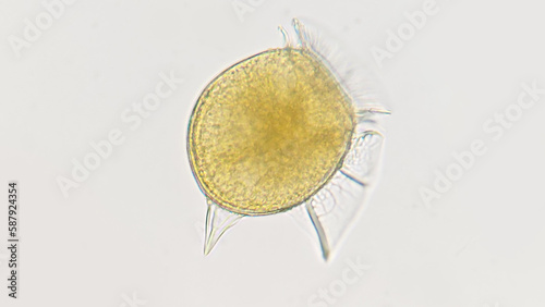 Dinophysis, a genus of dinoflagellates common in oceanic waters. Lugol-fixed sample. 400x magnification photo