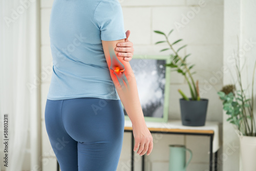 Diseases of the elbow joint, bone fracture and inflammation, woman suffering from pain in cubit photo