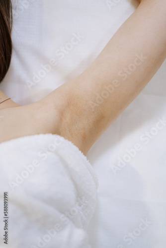 shaving arms with laser. beauty treatment
