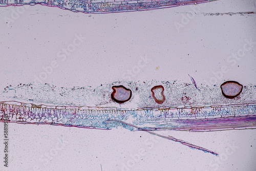 Host cells with spores (mold) are inside wood under the microscope for education.	 photo