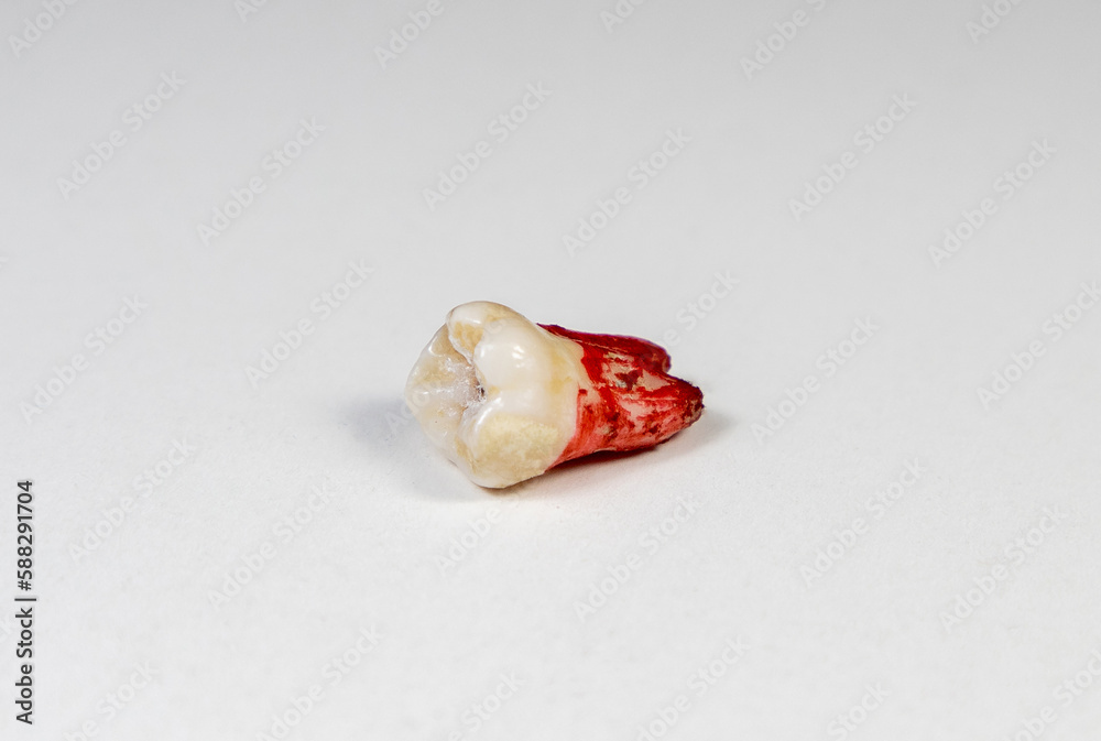 An extracted jaw tooth on a white background