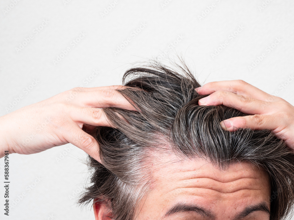 Obraz premium 白髪と薄毛を気にする男性の頭