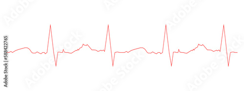 Electrocardiogram template. Heart beat diagram. ECG chart isolated on white background. Cardiac rhythm red line. Cardio test sign. Cardiology hospital symbol