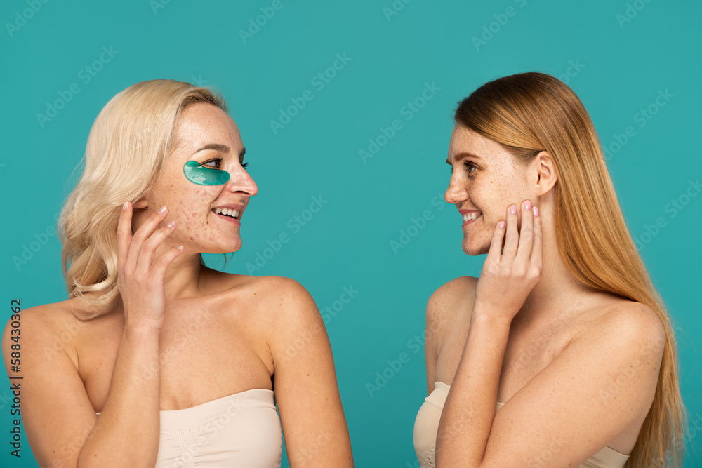 blonde woman with acne and eye patches smiling while looking at freckled friend isolated on turquoise. blonde woman with acne and eye patches smiling while looking at freckled friend isolated on turquoise.