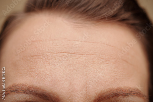 Closeup image of mature woman with forehead rows