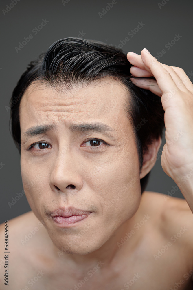 Worrying man checking his hairline, hair loss concept Worrying man checking his hairline, hair loss concept