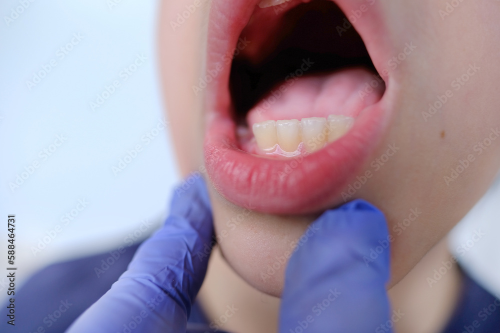 dentist, doctor examines oral cavity of small patient, boy 910 years