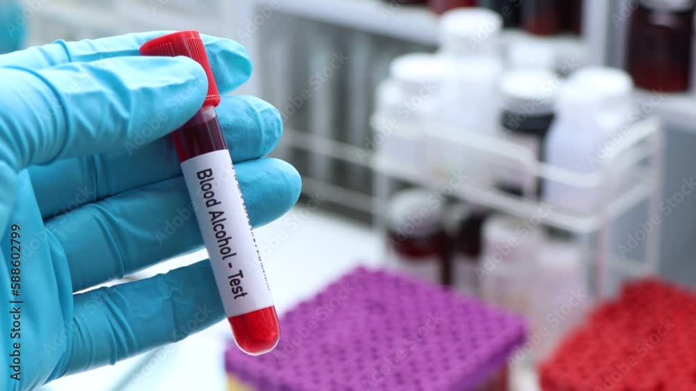 Blood Alcohol test to look for abnormalities from blood, blood sample