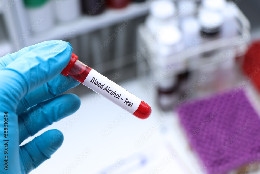 Blood Alcohol test to look for abnormalities from blood Blood Alcohol test to look for abnormalities from blood