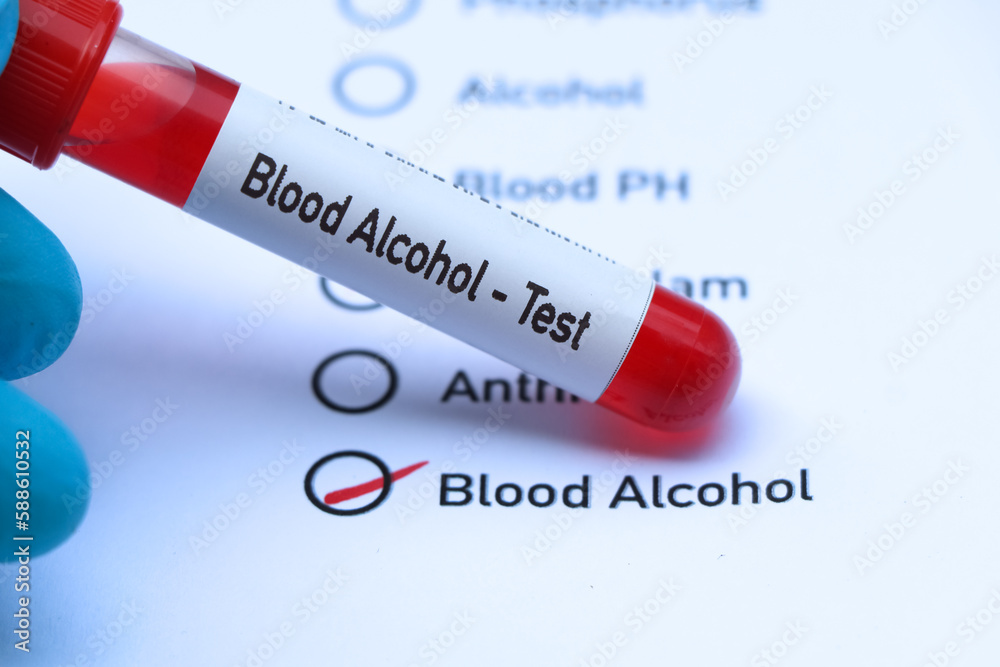 Obraz premium Blood Alcohol test to look for abnormalities from blood