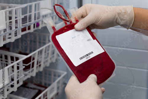 Leukocyte poor pack red cell in transfusion bag on a tray inside blood bank. Rare blood group prepares for donation or therapy of anemia patient in hospital