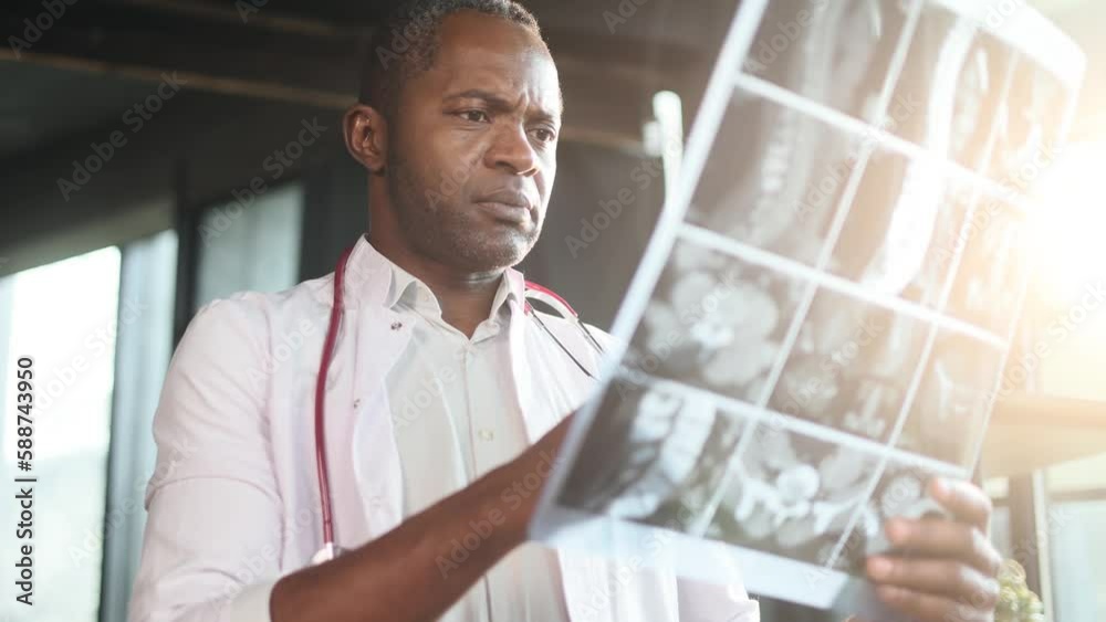 Portrait of shocked surprised scared african american man doctor therapist found something weird bad negative in diagnosis while looking at results patient MRI or CT scan procedure at office